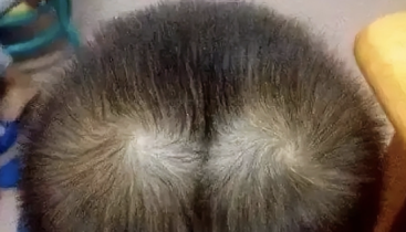 孩子头顶“2个旋”，你知道代表什么吗？看完涨知识