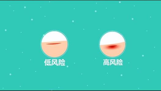 破伤风潜伏期最长可达数年什么情况要打破伤风针